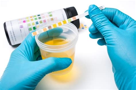 Urinalysis 